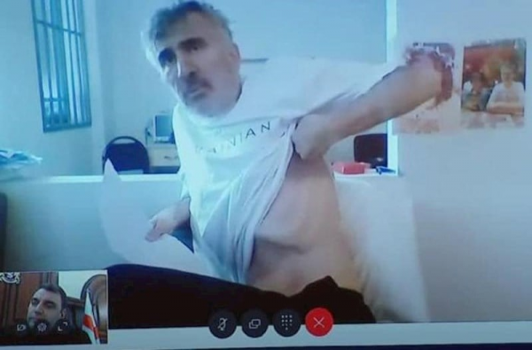 Saakaşvili yataq xəstəsi ola bilər