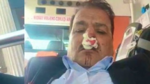 “Taliban”ı tənqid edən siyasi fəal Türkiyədə bıçaqlandı