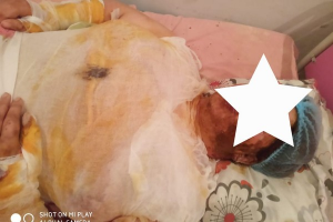Yaşadığı şəxs tərəfindən şiddət görən qadın özünü yandırdı