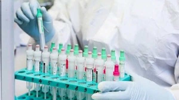 Tailandda yeni virus aşkarlandı